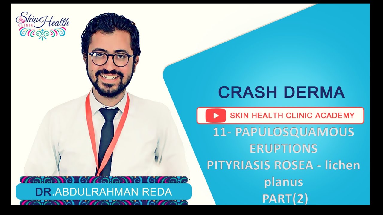 11- PITYRIASIS ROSEA  LICHEN PLANUS  (2)شرح الجلدية النخالة الورديه والحزاز د.عبدالرحمن رضا