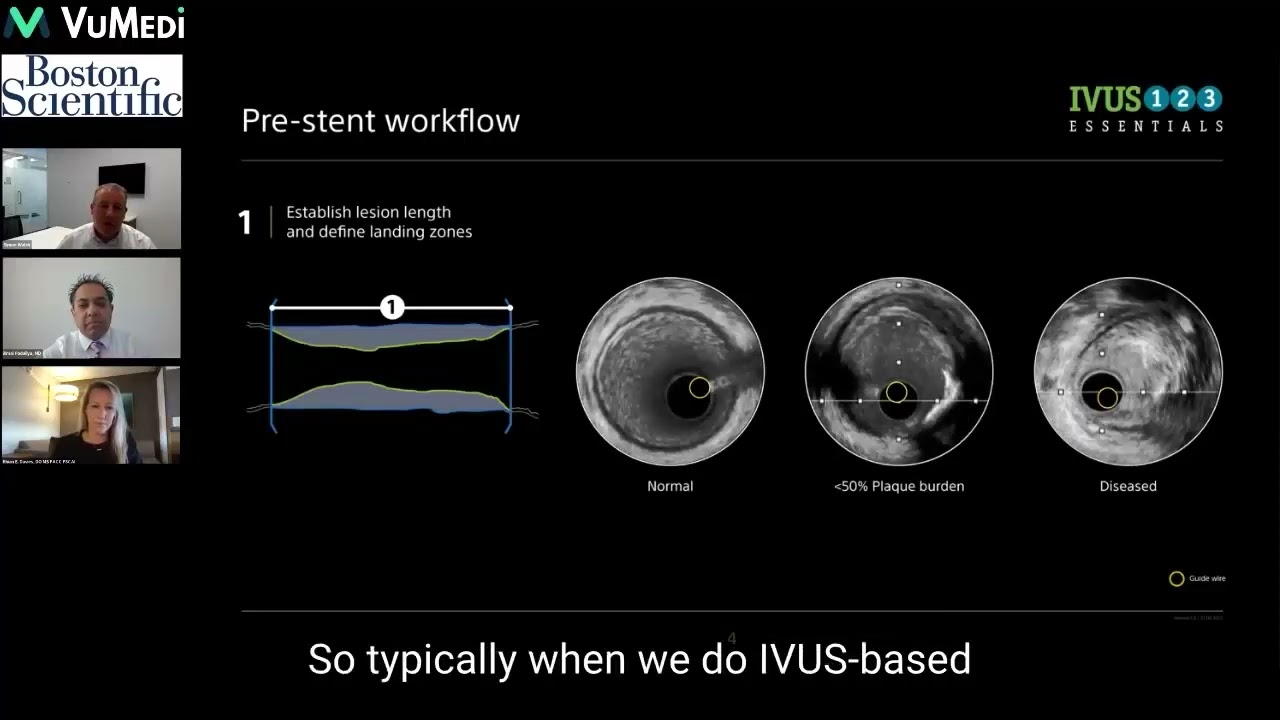 IVUS 123: The Essentials to the IVUS Imaging Workflow