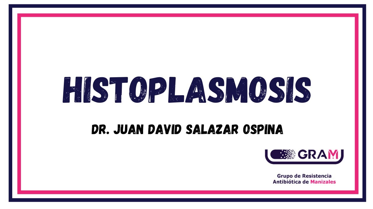 Histoplasmosis