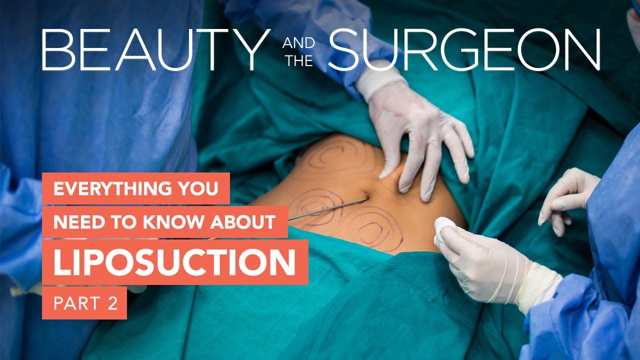 Everything You Need to Know About Liposuction - Part 2 - Beauty and the Surgeon Episode 182