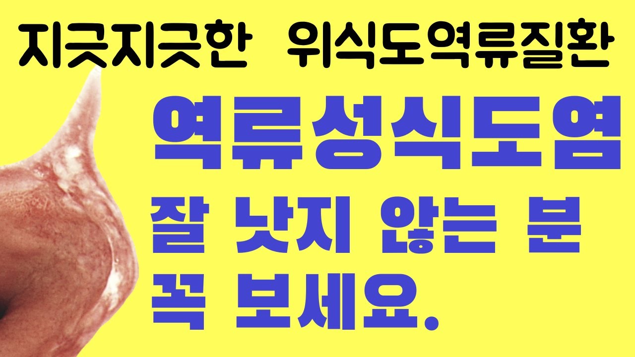 잘 낫지 않는 역류성 식도염 치료 #식도염 #역류성식도염 #위식도역류질환