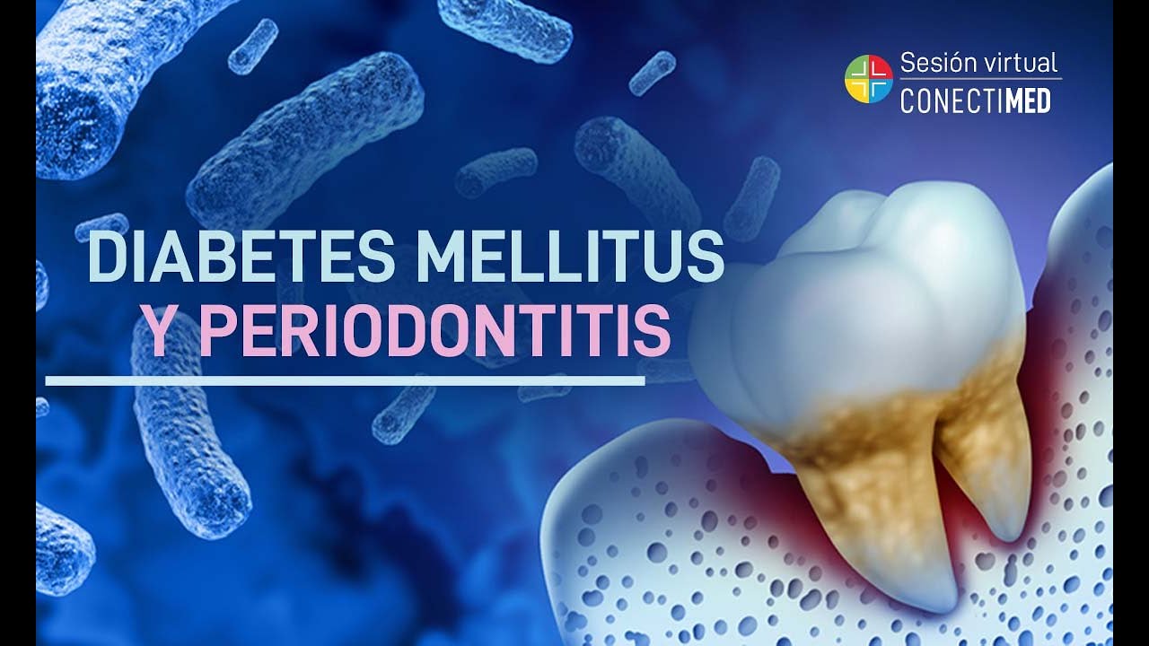Sesión Virtual: Diabetes Mellitus y Periodontitis