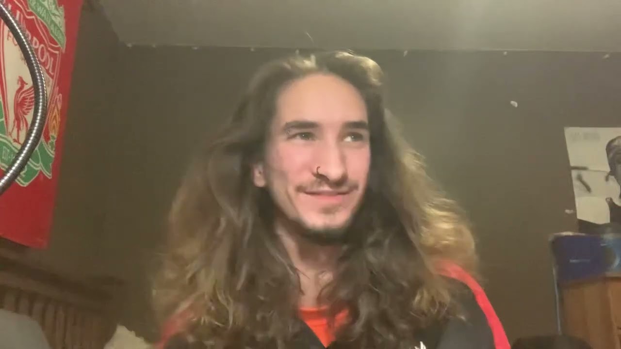 Men’s 24 Month Hair Growth Update! (2 Years!)