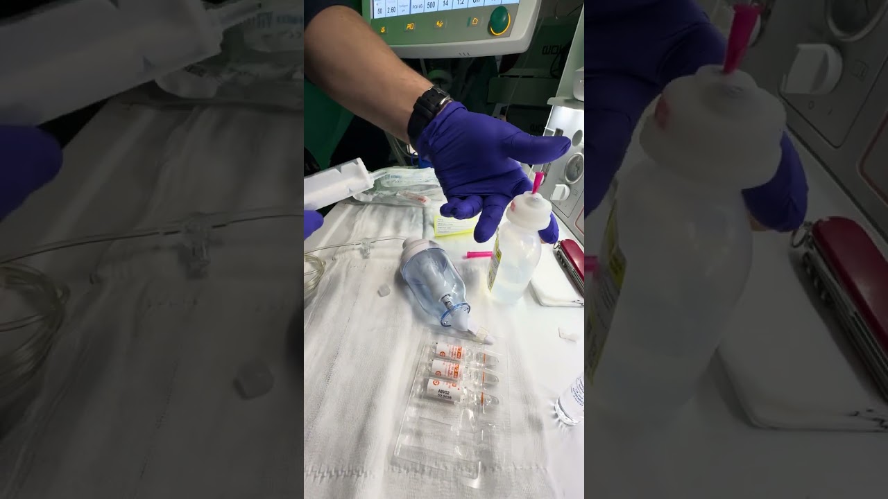 Preparando la bomba elastomérica para la analgesia en el by pass gástrico.