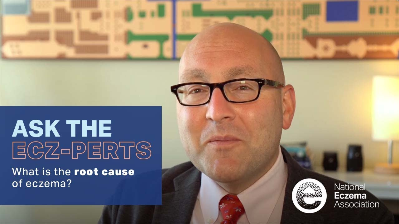 Dr. Peter Lio Answers 