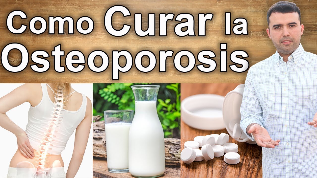 Que es la Osteoporosis - Remedios Caseros para Curar el Dolor de Huesos