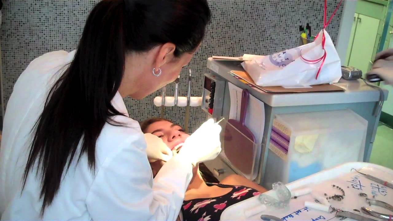 Getting braces off at Statler Orthodontics in Boca Raton, FL