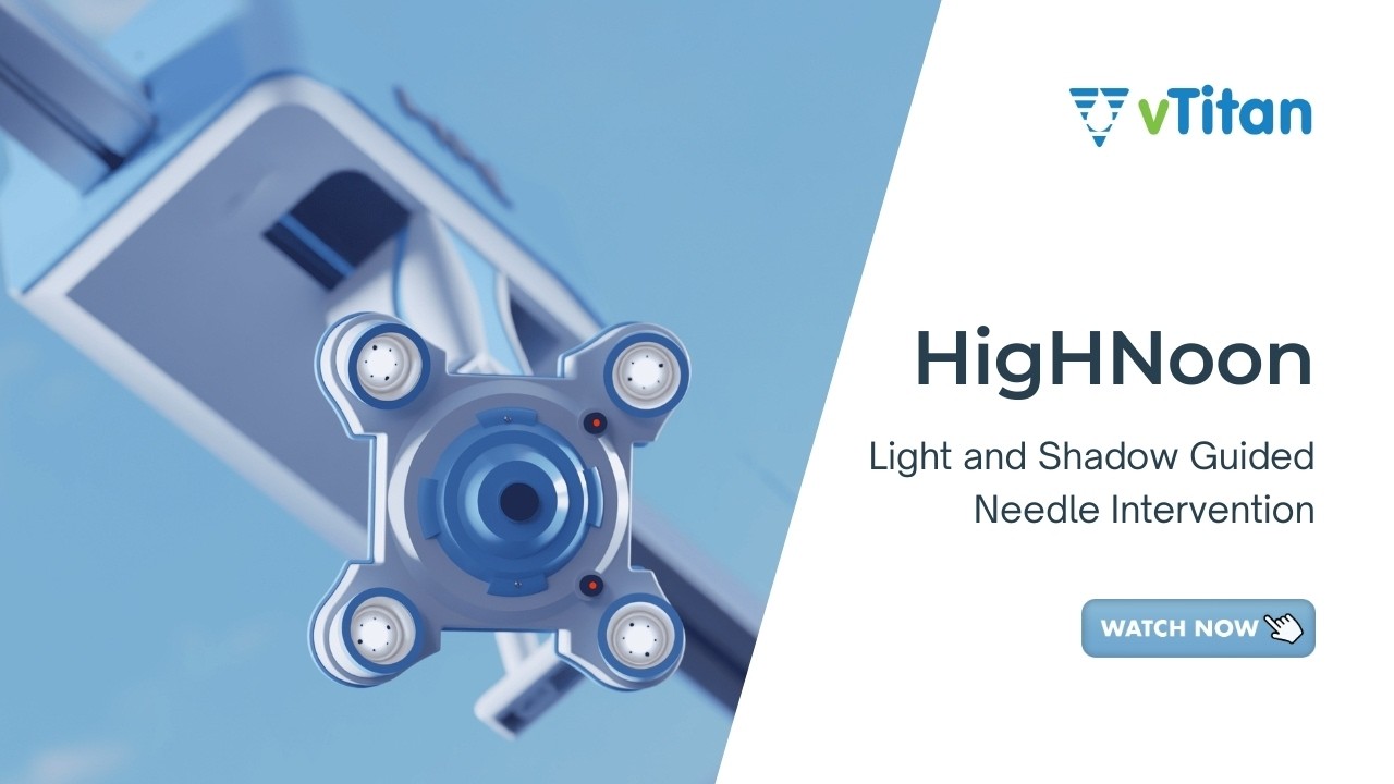 HigHNoon – Light and Shadow Guided Needle Intervention