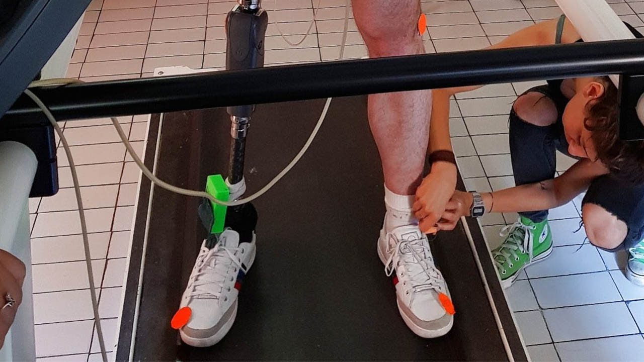 Bionic leg allows amputees to 