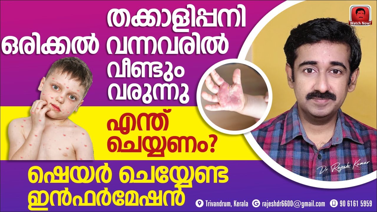തക്കാളിപ്പനി ഒരിക്കൽ വന്നവരിൽ വീണ്ടും വരുന്നു.. എന്ത് ചെയ്യണം ? ഷെയർ ചെയ്യേണ്ട ഇൻഫർമേഷൻ