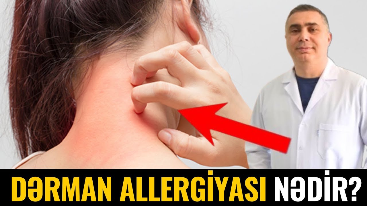 Dərmana Qarşi Allergiyası Olanlar Bunlara Diqqət Edin YOXSA...