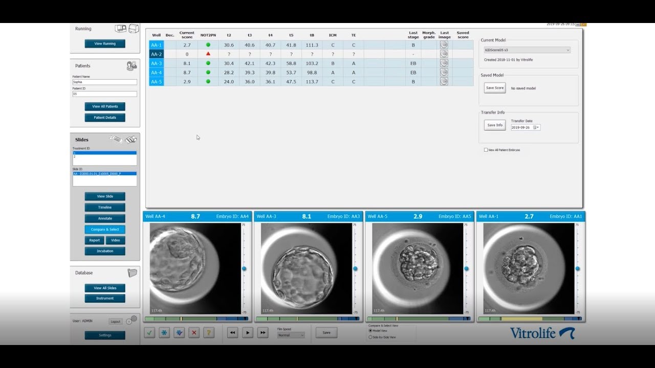 Compare and Select – optimising embryo evaluation