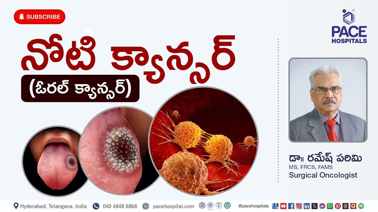 నోటి క్యాన్సర్ - దశలు, కారణాలు, ప్రమాద కారకాలు, నిర్ధారణ, చికిత్స & నివారణ | Oral Cancer Telugu