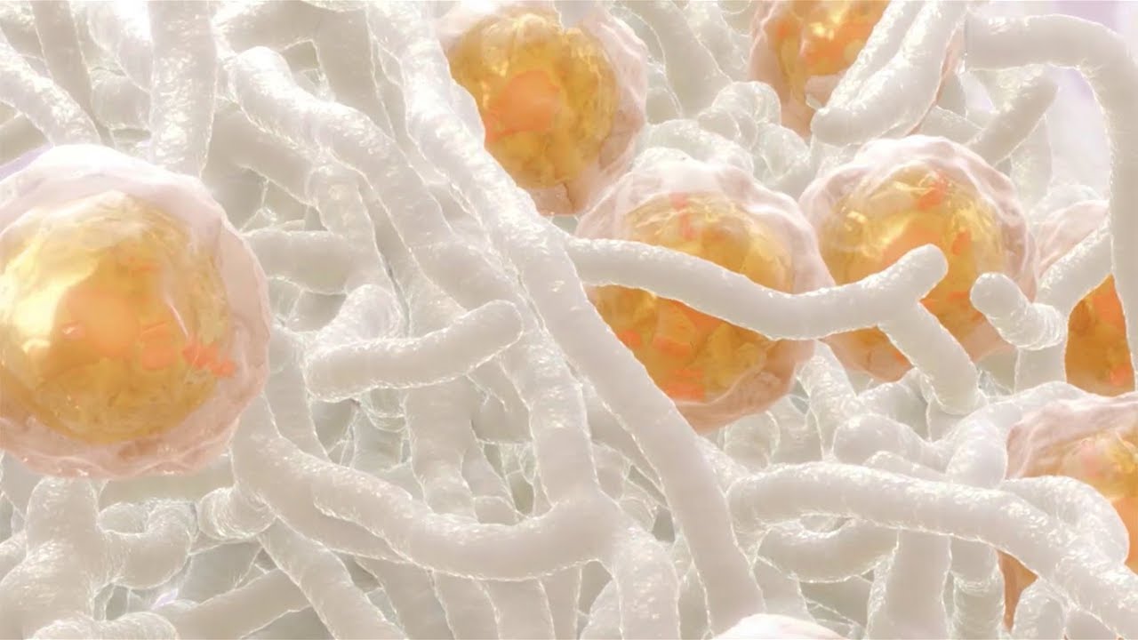 The science behind MACI: unlocking the potential of your patient's own cells