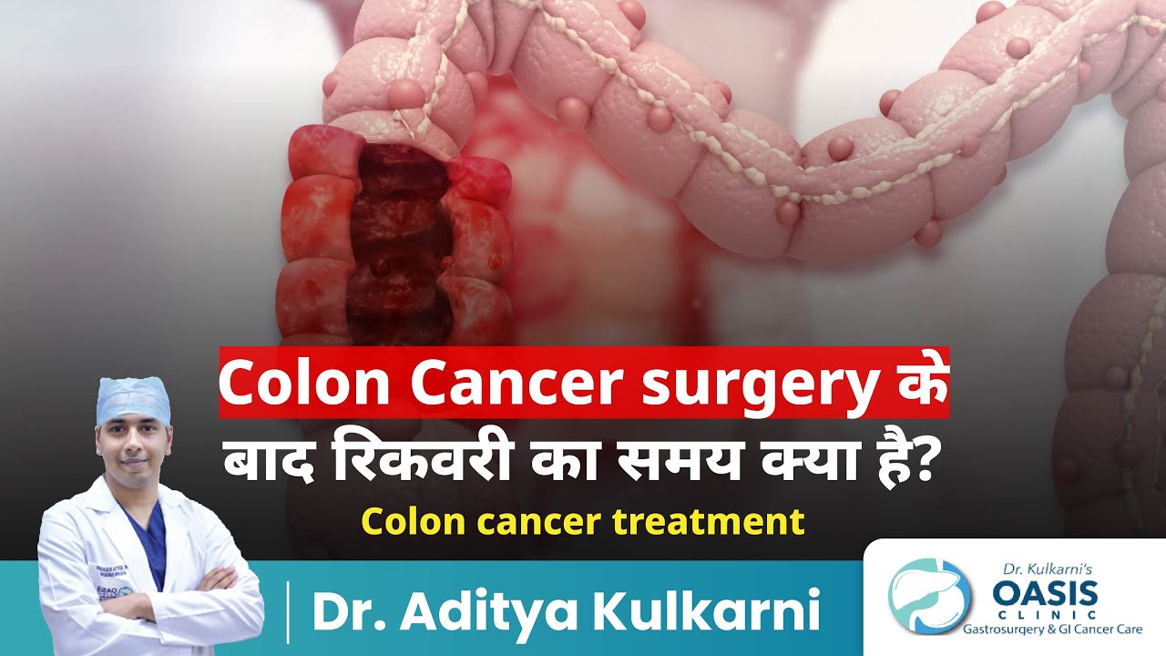 Colon Cancer surgery के बाद रिकवरी का समय क्या है? | Colon cancer treatment | Dr Aditya Kulkarni
