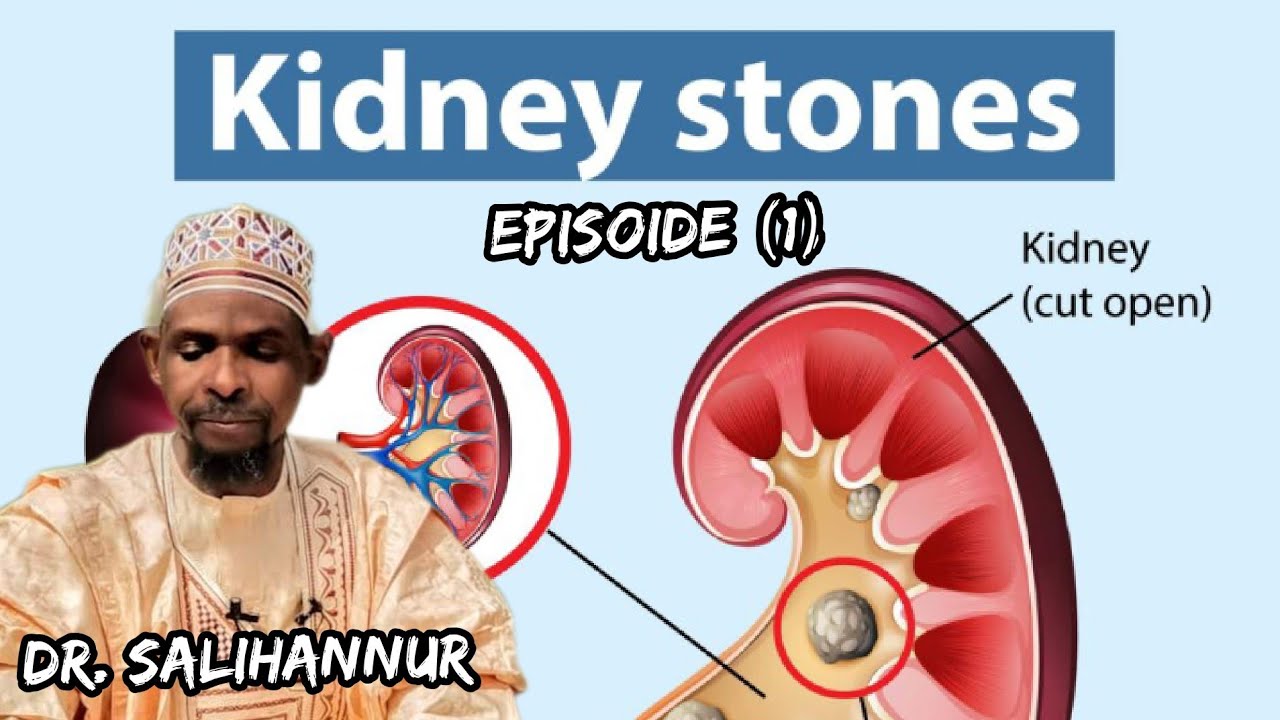 Dr. Salihannur) Matsalolin Ciwon Koda #kidney #Storne (#Episode 1 ) Daga Dr. Salihannur