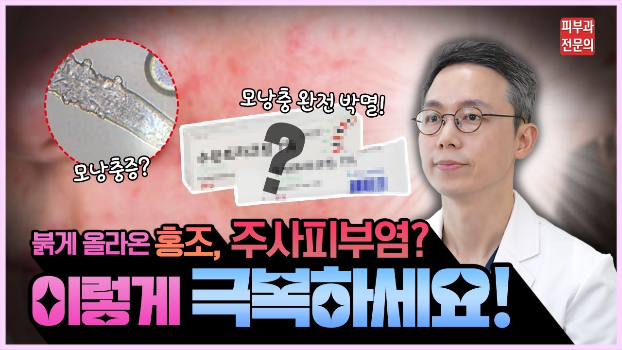 주사피부염 없애고 싶다면 '이것' 필수! 쉽게 주사피부염 극복하는 방법 [송도휴먼피부과]