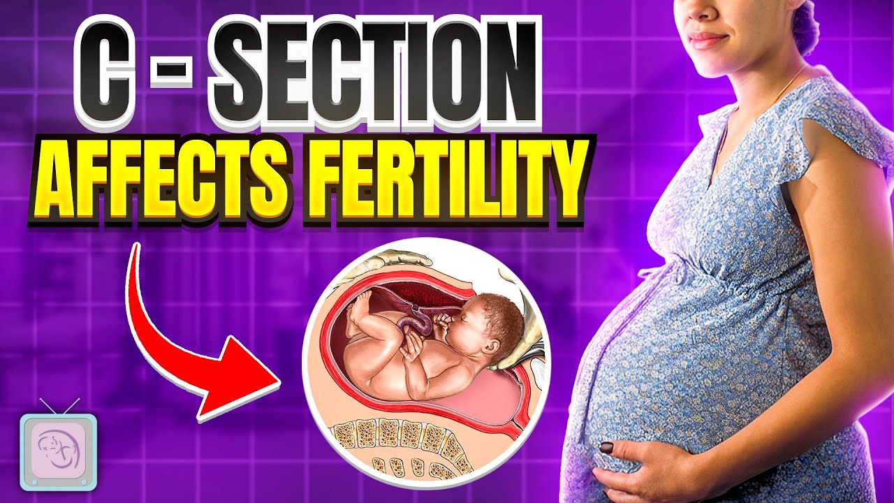 Are you having trouble trying to conceive again? It might be because of your C-Section