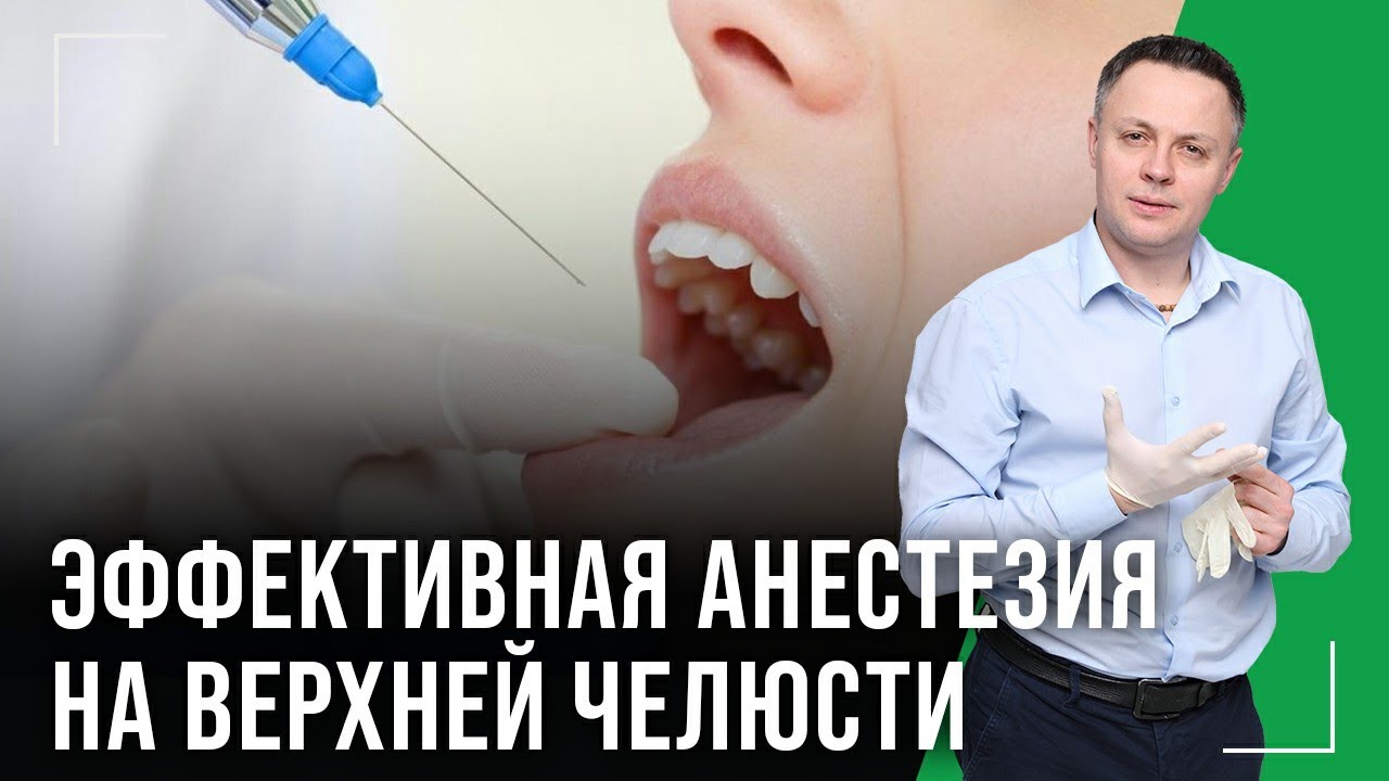 Анестезия на верхней челюсти