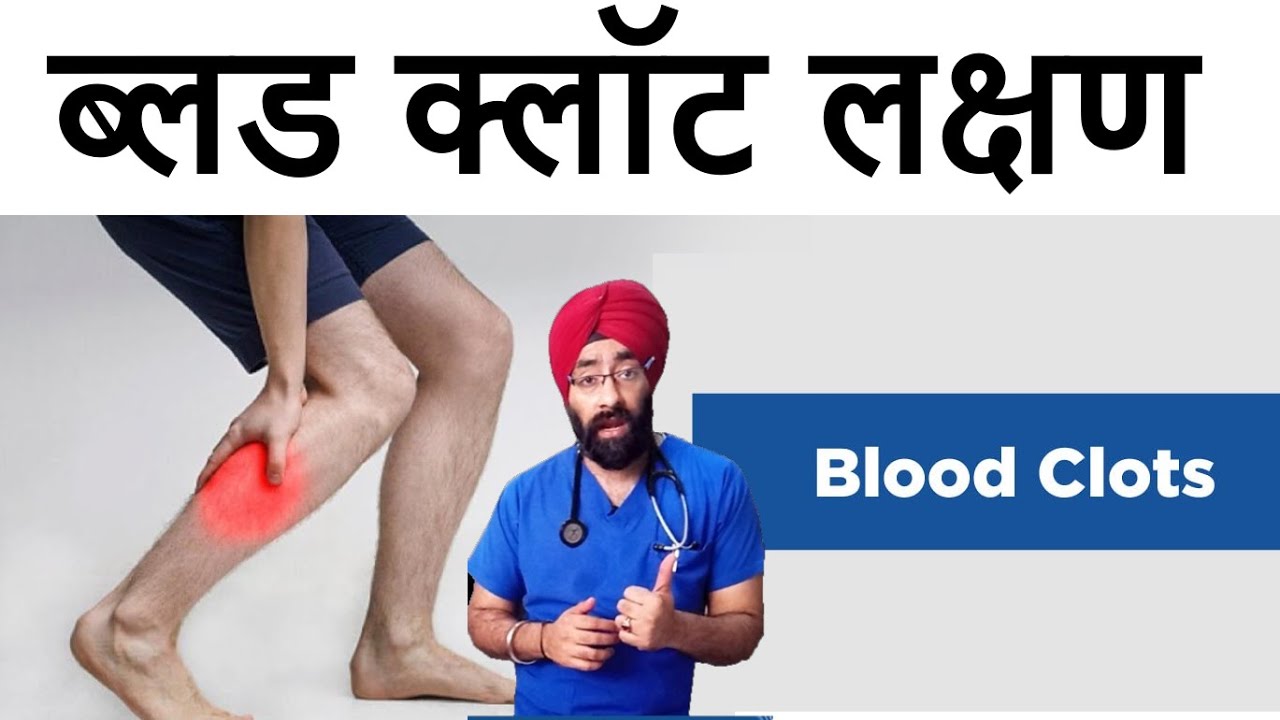 ब्लड क्लॉट | Blood Clot in your Legs | Peripheral Artery disease | PAD | Dr.Education