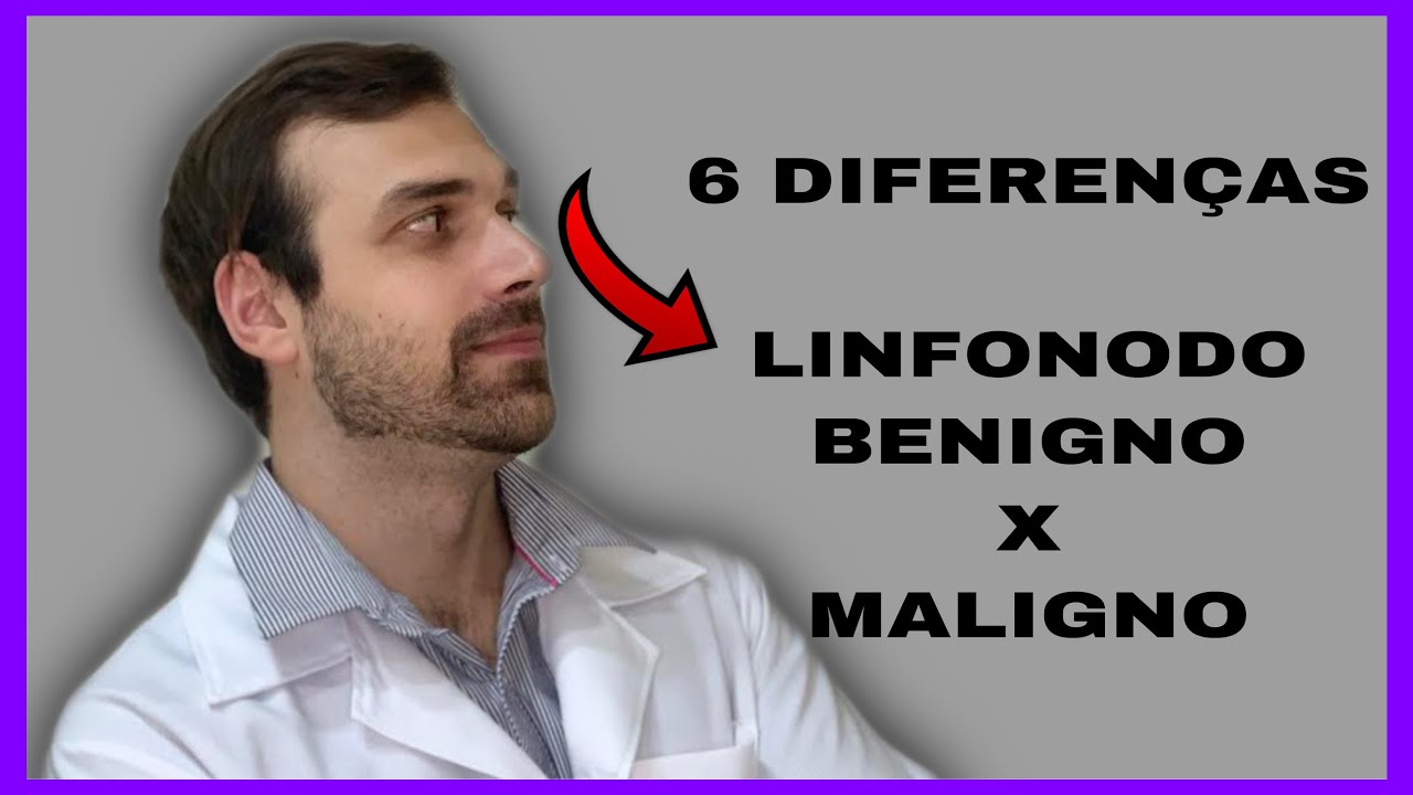 Linfonodo Benigno x Câncer - 6 diferenças entre ínguas malignas de reacionais