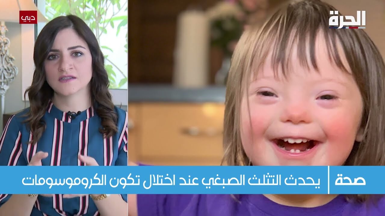 التثلث الصبغي, كيفية حدوثه وطرق الكشف عنه