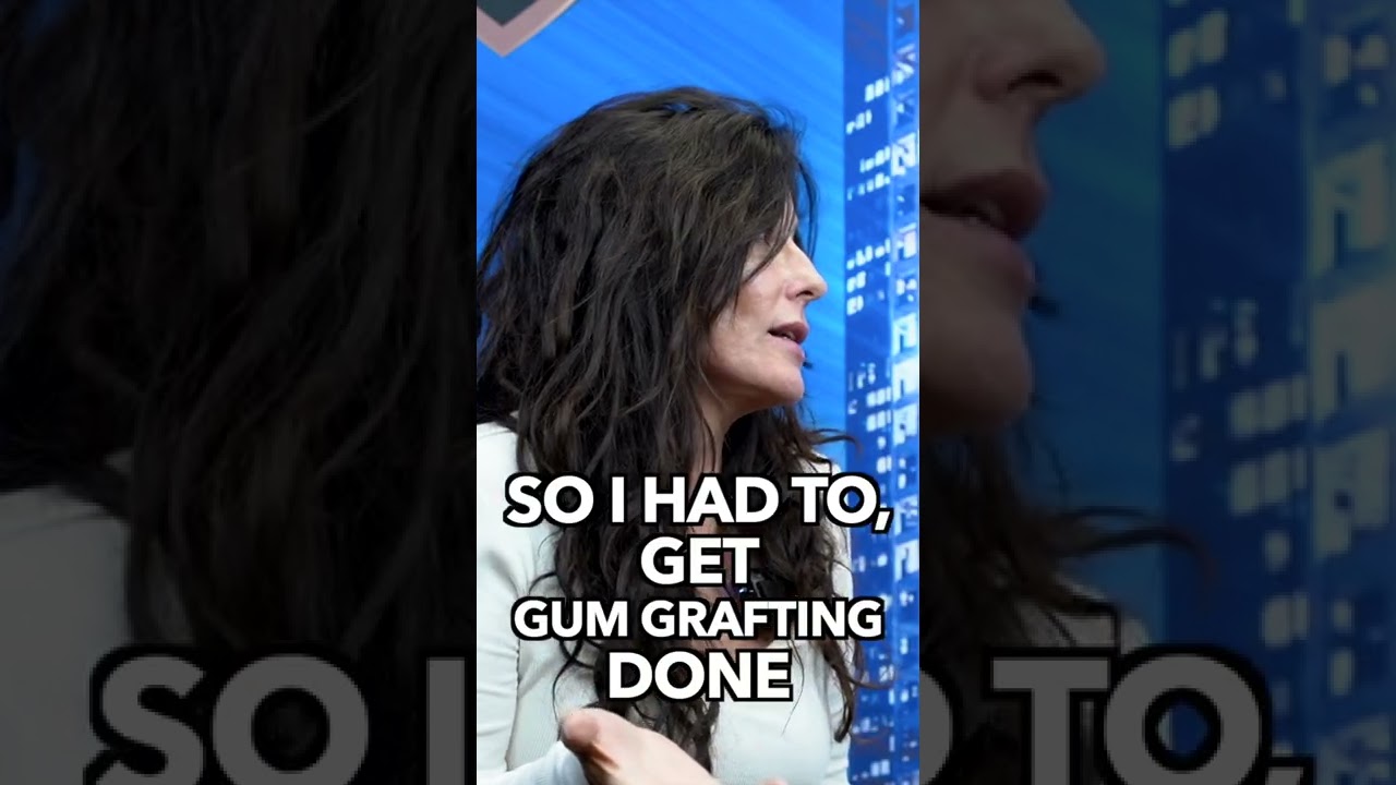 Chao Pinhole&reg; Surgical Technique: Conventional Gum Grafting Didn't Last