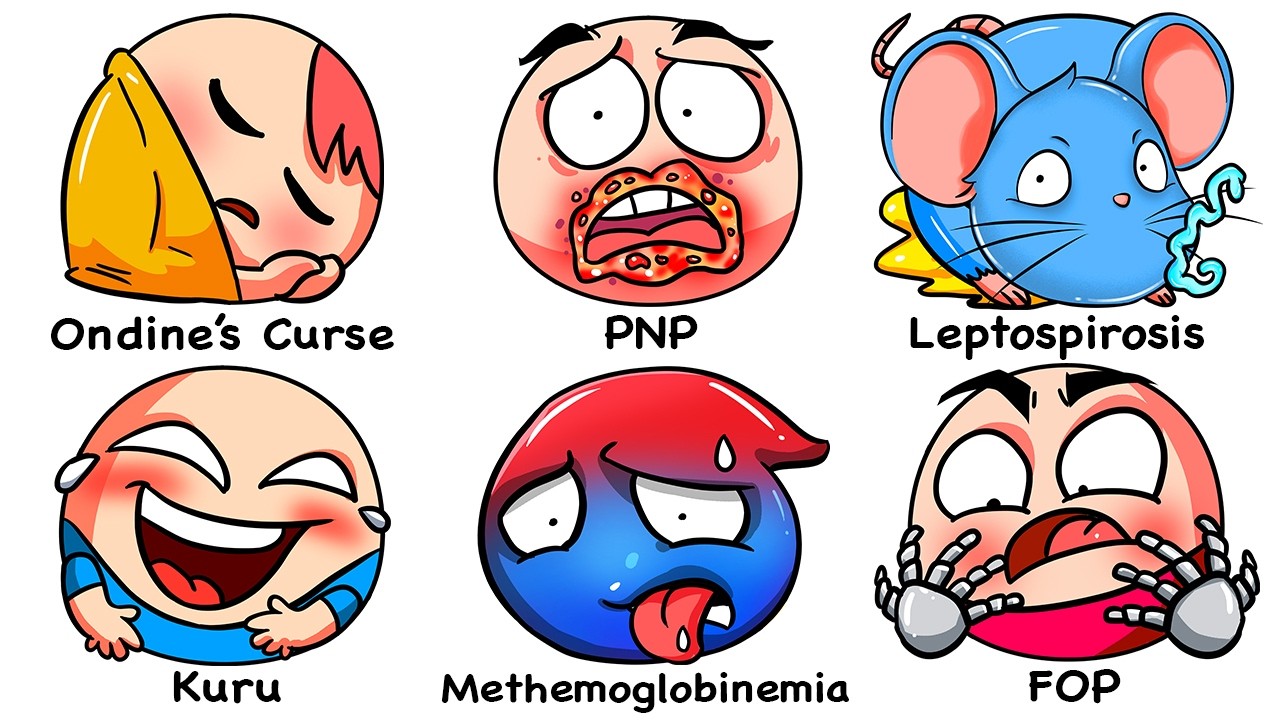 Every EXTREMELY Rare Disease Explained In 20 Minutes