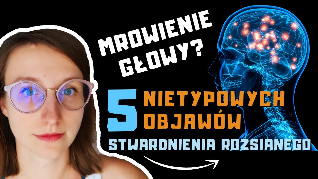 Mrowienie głowy, nocne poty, brak węchu – neurologiczne OBJAWY stwardnienia rozsianego?| O, choroba!