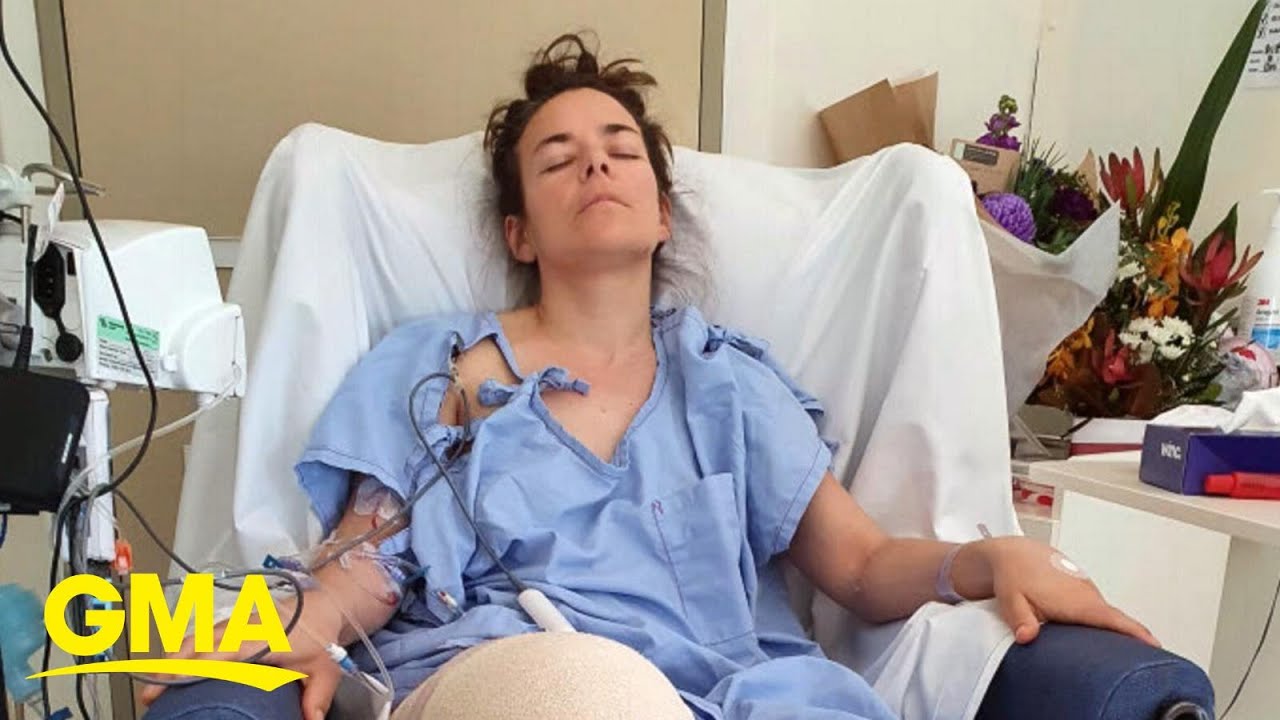 Woman speaks out after surviving great white shark attack l GMA