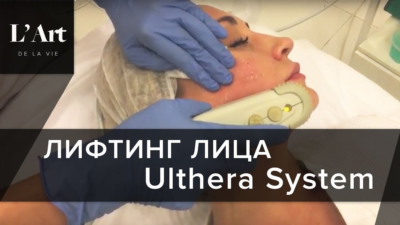 Лифтинг лица Ulthera System