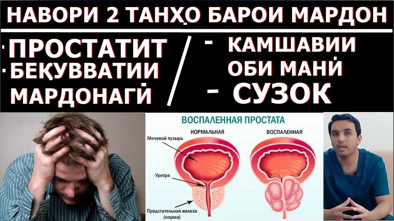 Простатит, сустшавии мардонаги, камшавии сперма, чакидани пешоб, массажи простата.