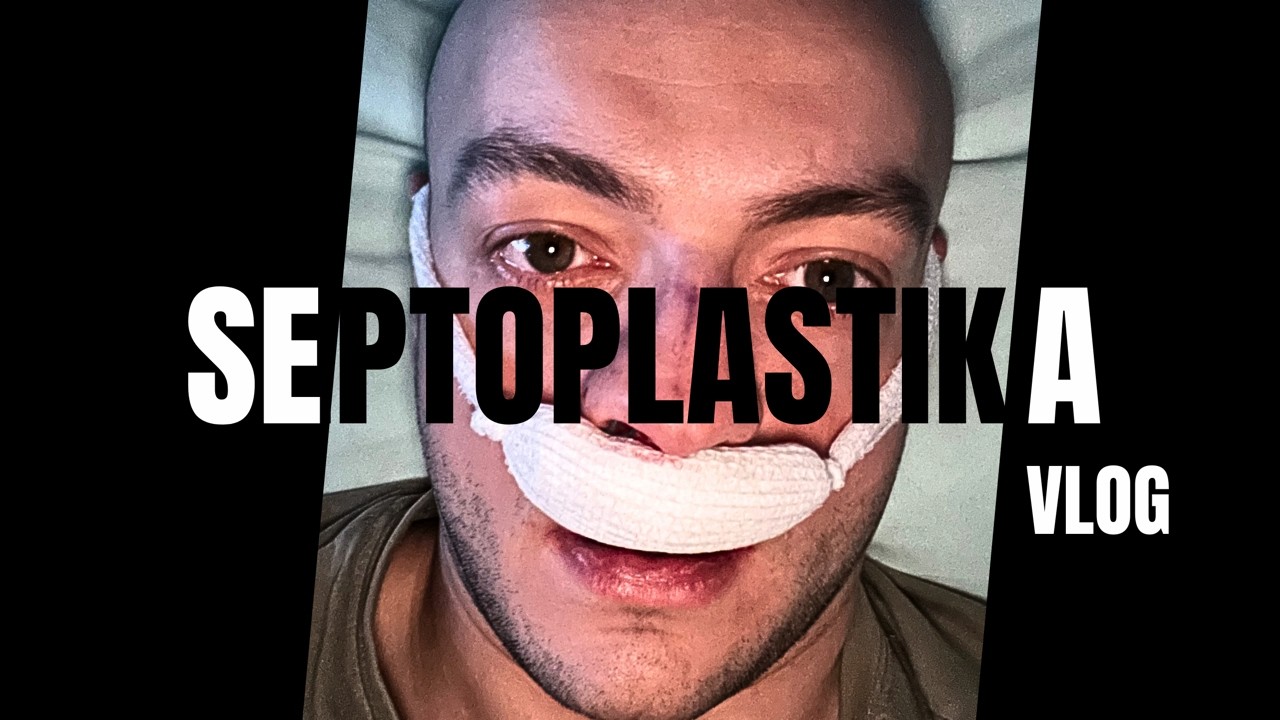 LÉČBA CHRONICKÉ RÝMY - OPERACE NOSU - SEPTOPLASTIKA VLOG
