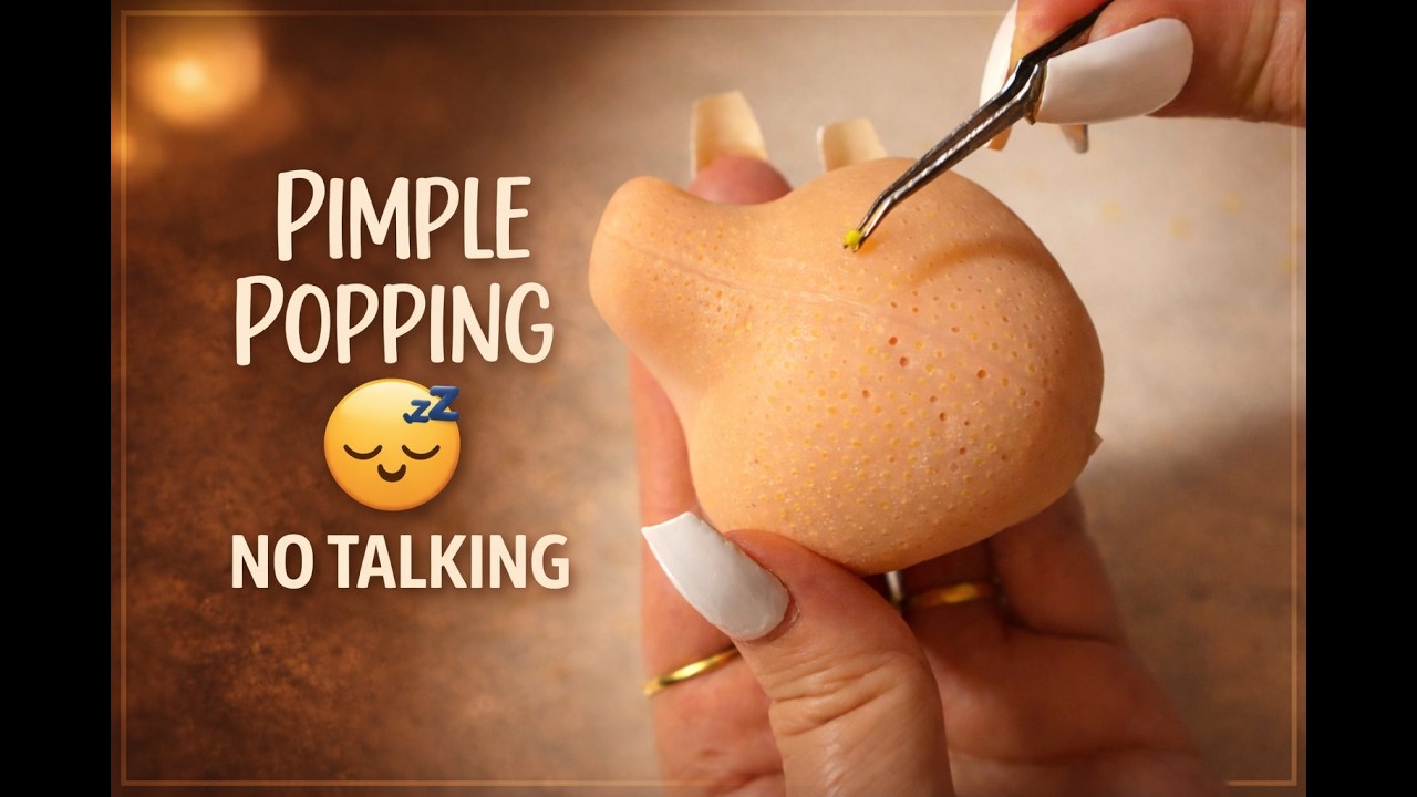 Gentle Pimple Pop ASMR 😴 Soft Picking & Relaxing Sounds No Talking, 30 Minutes