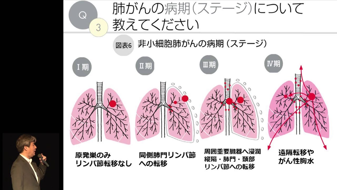 肺がんの概要 藤高一慶