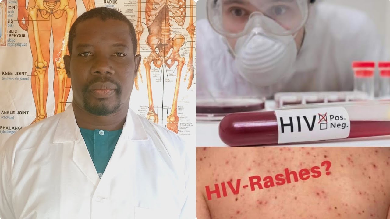 Kiwon Lafiya || Maganin HIV (AIDS) Gangariya Tare da Dr. Adam Salisu Hassan.