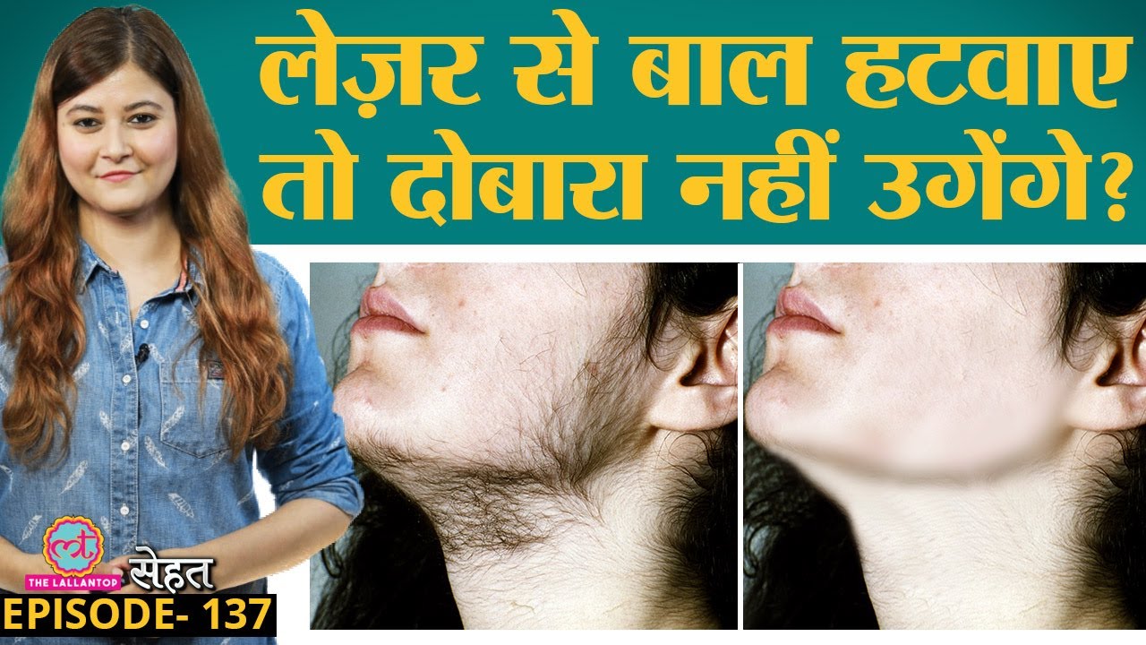 Laser से Hair Removal यानी अनचाहे बाल हटवाना चाहते हैं तो पहले Side Effects जान लें | Sehat ep 137