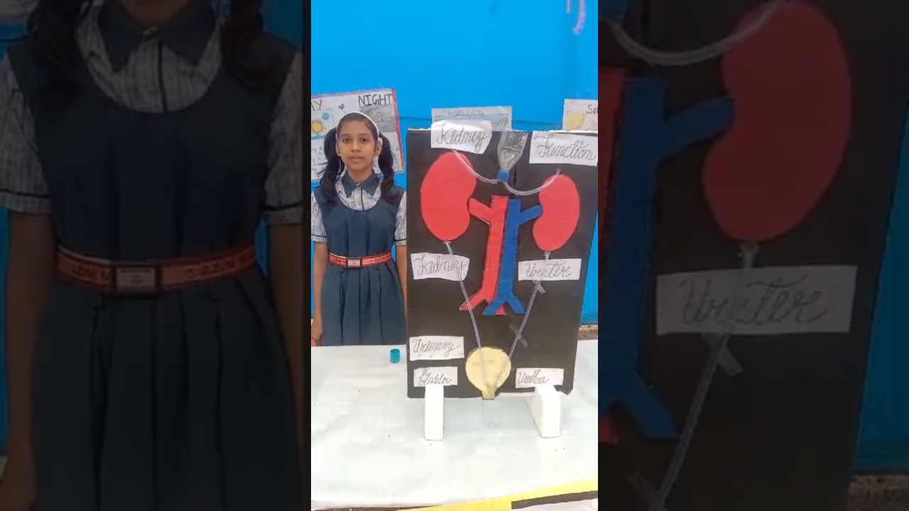 Kidney Analysis | Science Exhibition 