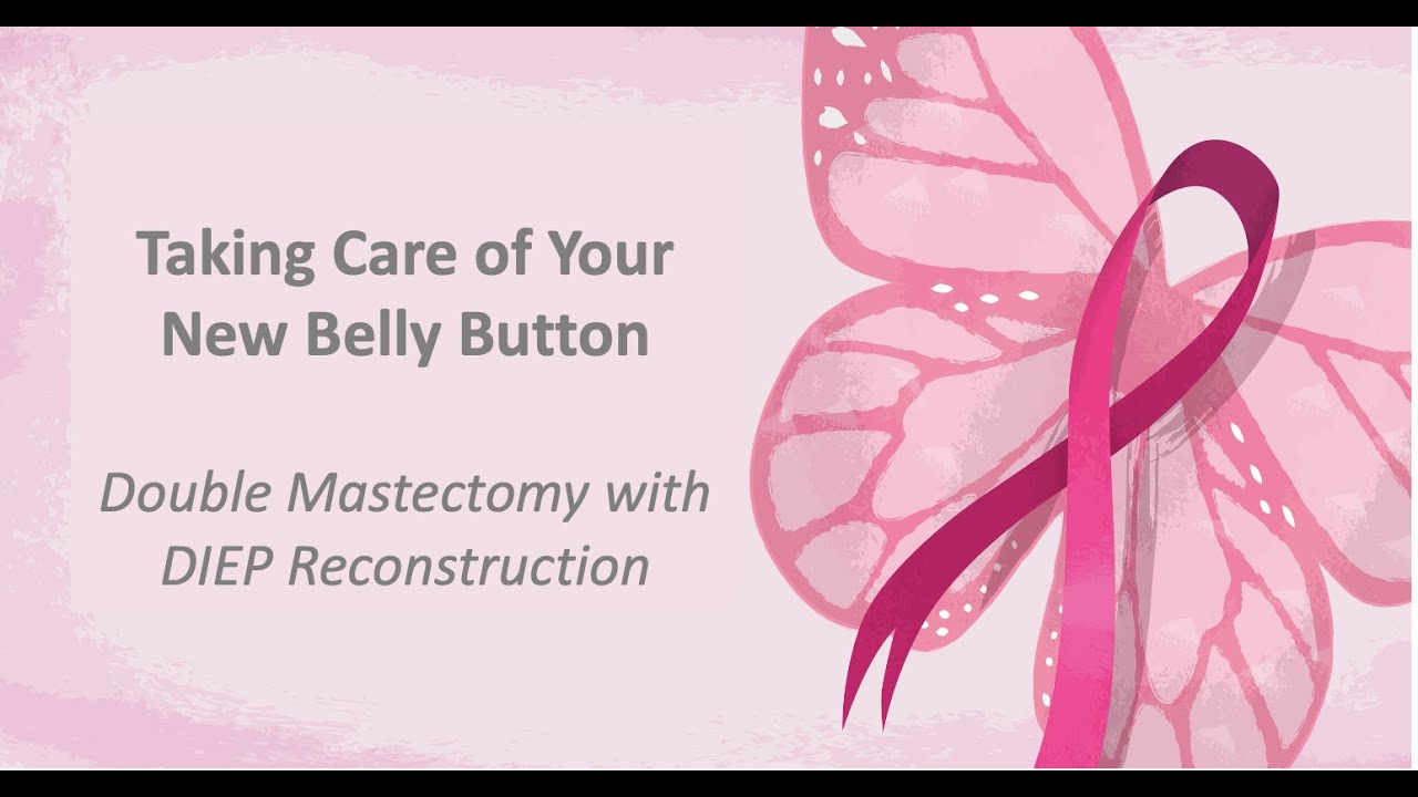 Taking Care of Your New Belly Button / Double Mastectomy with DIEP Reconstruction