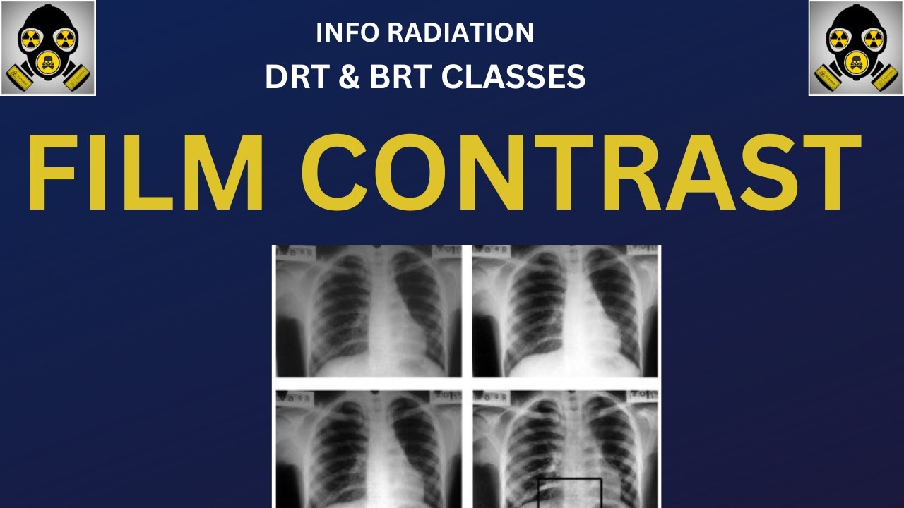 film contrast in radiography | drt and brt online classes | info radiation