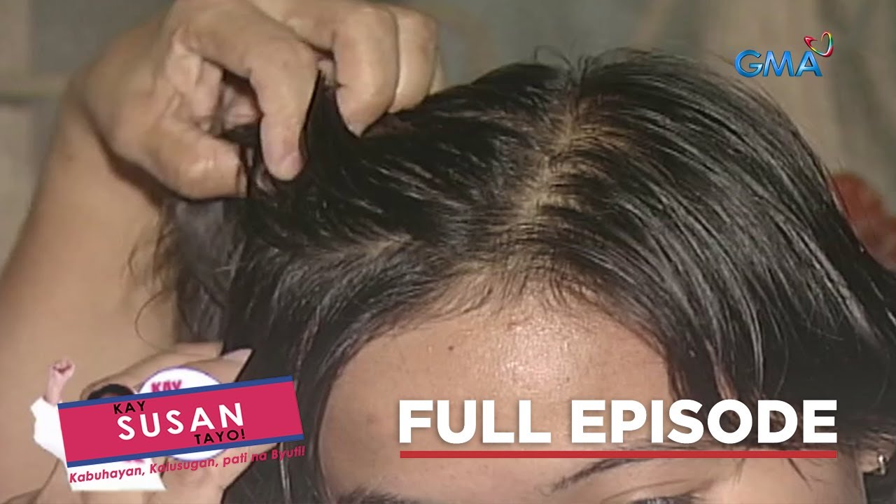 Makating anit, ano ba ang sanhi nito? Full Episode 28 (Stream Together) | Kay Susan Tayo!