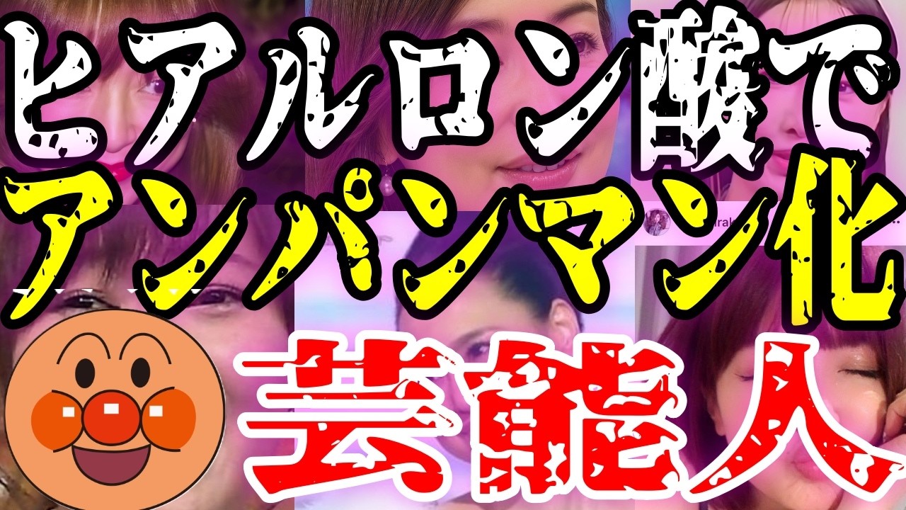 【ホラー級】「整形でアンパンマンみたいな頬になっていく女優多すぎ」...ヒアルロン酸やりすぎ芸能人「それでも何で皆やるんだろ？」【ガルちゃんまとめ】