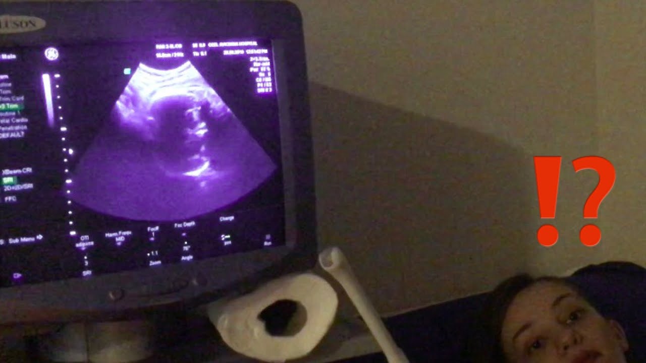 Doğumdan habersiz son doktor kontrolüm 🙈 gebelikte 36. Hafta