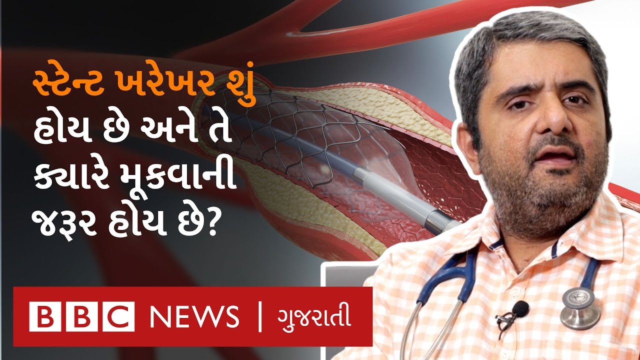 Angioplasty(ઍન્જિયોપ્લાસ્ટી) અને Angiography (ઍન્જિયોગ્રાફી) શું છે? એકદમ સરળ શબ્દોમાં સમજો