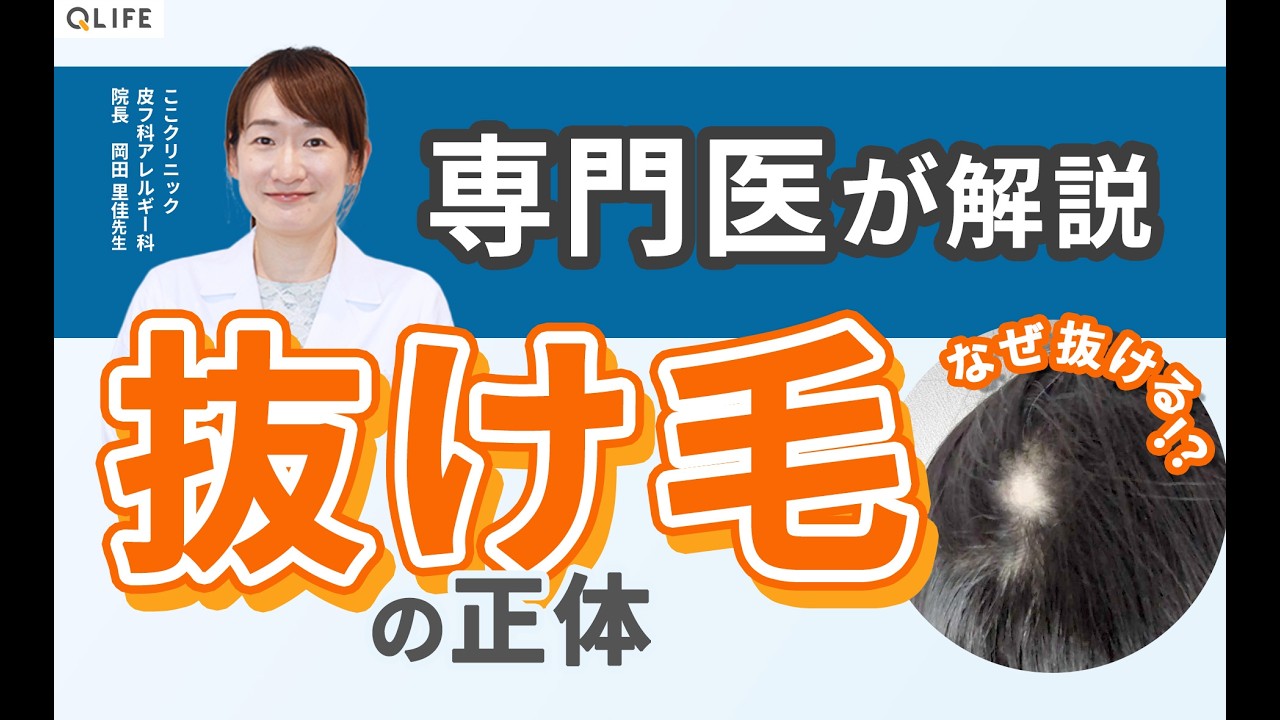 専門医が解説！抜け毛・脱毛症の基礎知識　～なぜ抜ける？種類別に徹底解説～　【前半】