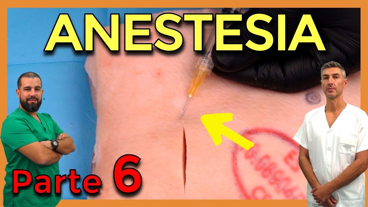Cómo PONER ANESTESIA antes de SUTURAR – CIRUGÍA MENOR y SUTURAS (Parte 6)