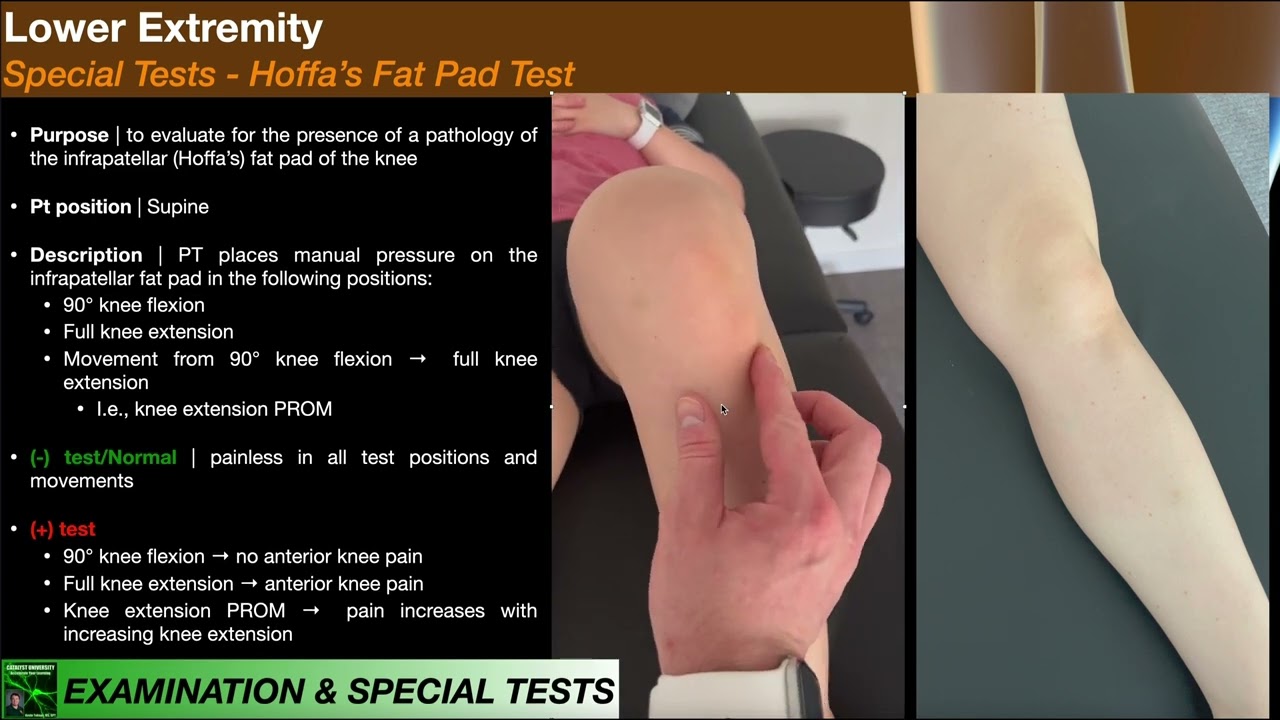 Infrapatellar (Hoffa's) Fat Pad Test