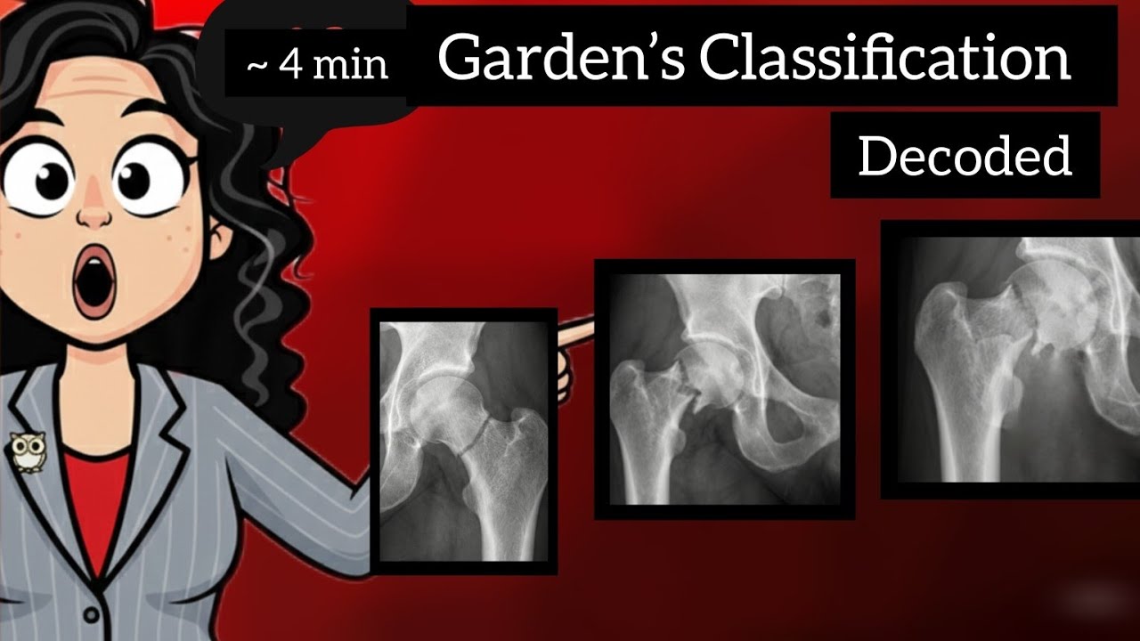 Garden Classification DECODED - One Shift That Decides Every Stage 