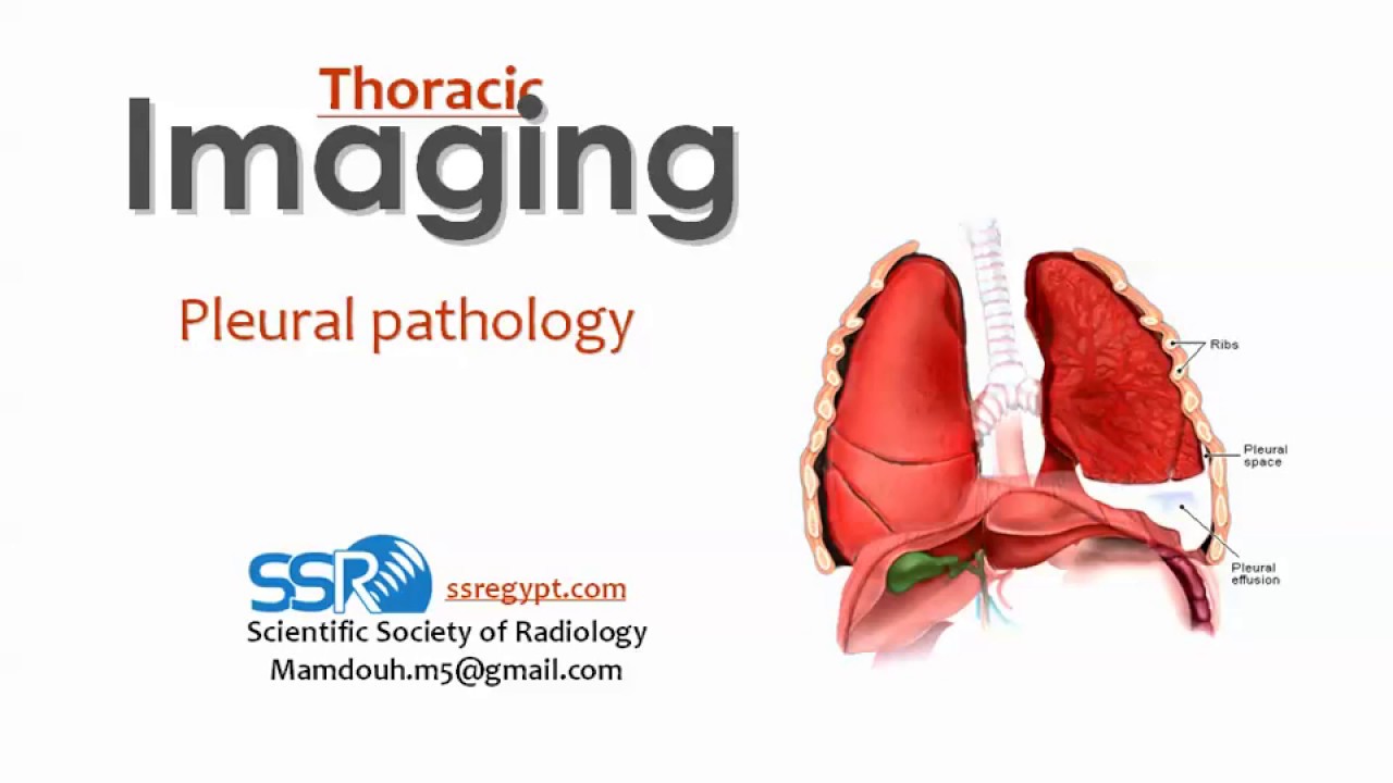 9 Plural pathology Imaging - prof.Mamdouh Mahfouz (2019 edition)