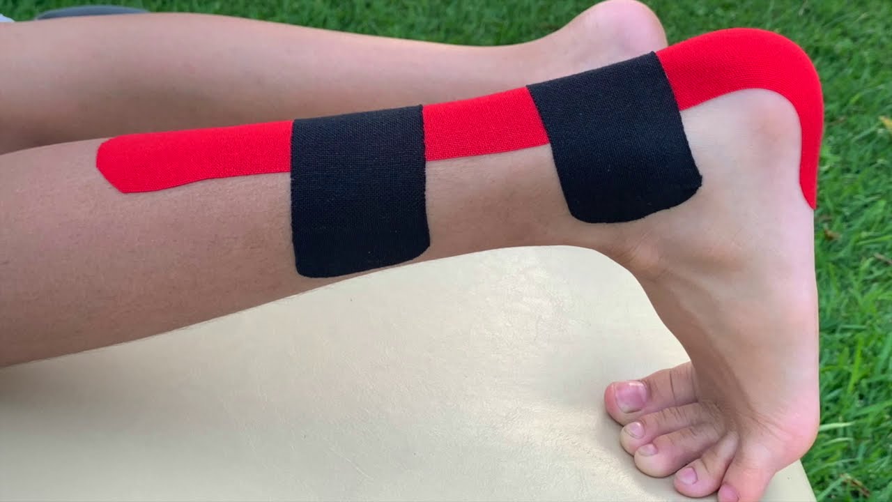 Kinesiotaping para Tendinitis de Aquiles